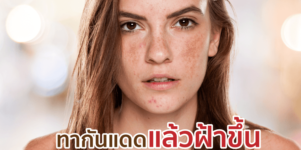 Content – 5